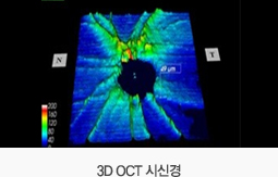 3D OCT 시신경